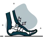 Osteoartrose