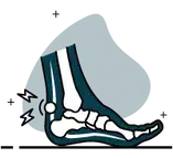 Insuficiencia tibial posterior
