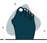 Hallux valgo